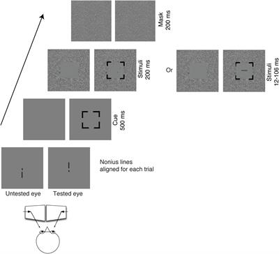 Feature Counting Is Impaired When Shifting Attention Between the Eyes in Adults With Amblyopia